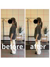 熊本カワル整体 JR上熊本駅院/姿勢改善