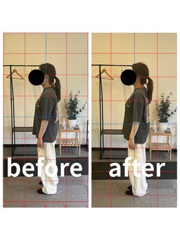 熊本カワル整体 JR上熊本駅院/姿勢改善