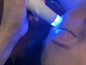 ビューティコア 二子玉川/目元・口元・ほうれい線ケア