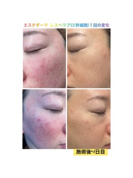 プリオール 太田店(Prior)/エステダーマ×幹細胞