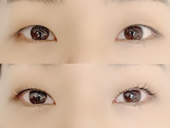 シクラプ(siklap)/before→after