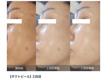 ストーリー 小田原(STORY)/韓国最新★ダクトピール