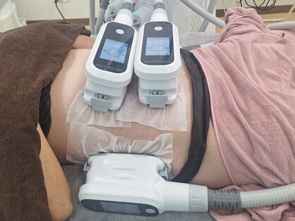 ステラ(Stella)の写真