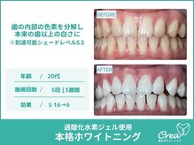 クレア(Crea)/【ホワイトニング症例写真】