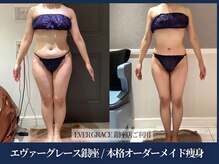エヴァーグレース 宇都宮店/ 燃焼系BODY作りサポートします
