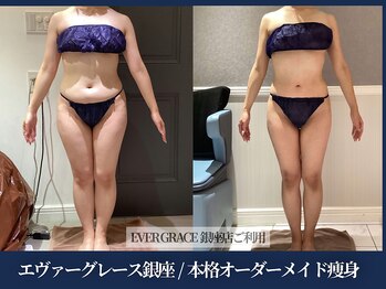 エヴァーグレース 宇都宮店/ 燃焼系BODY作りサポートします