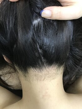 ナノハナ/鹿沼市本格脱毛の美容室ナノハナ