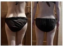 アクアリジェ/痩身リンパ1回の変化