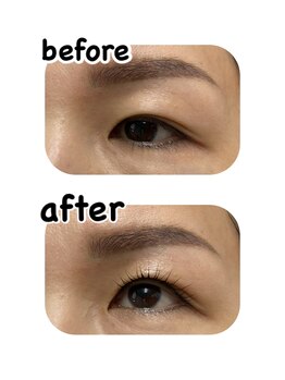 ファーストアイ(First eye)/マイラミネーション