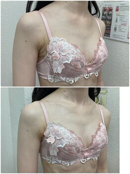 バーディー(BIRDIE)/施術１回/2０代