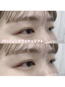 レディエント(Radiant)/パリジェンヌラッシュリフト