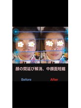 美容矯正サロン レレポノ(LELEPONO)/