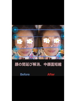 美容矯正サロン レレポノ(LELEPONO)/