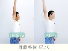 ヒラメント 桜新町(Hilament)/肩こりビフォーアフター〈整体〉