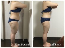 痩身モニター様120分22回の結果のお写真　