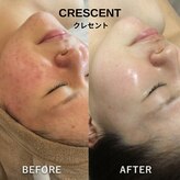クレセント(CRESCENT)