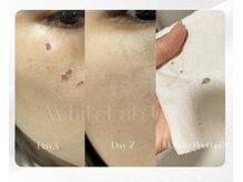 キノ(Kino)/ホワイトラボ