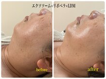 グラン ジュテの雰囲気（韓国発LDM高密度超音波と美容液の相乗効果で小顔と美肌をつくる）