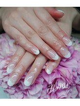 アイネイル(iNAIL)/