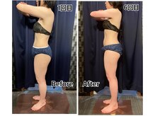 トリニティ 横浜店(TRINITY)/二の腕もホッソリ！