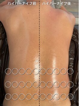 フィエルテ 甲斐敷島(FIERTE)/上半身施術 背中