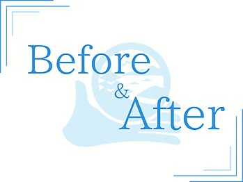 むねなが鍼灸接骨院/【ダイエット実績】