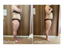 サンニロク(326)/３０代お客さま/８回施術