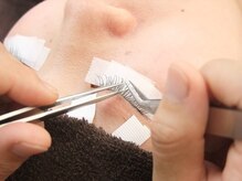 アビオ 戸田店(ABIO)/施術風景