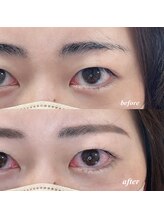 リマ(Lima)/まつげカールアイブロウ同時施術