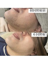 テンパ ビューティー(+10%beauty)/効果写真