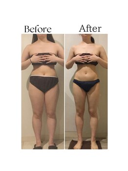 ラヴィニティ 池袋店(Lavinity)/業界初!通い放題 ダイエット