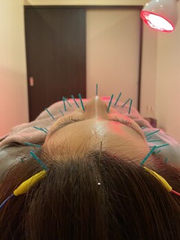 ポルクス鍼灸整骨院 表参道(Pollux鍼灸整骨院)/美容鍼灸