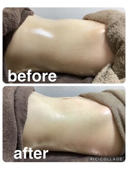 ギンザアール(GINZA R.)/ぽっこりお腹にアプローチ！