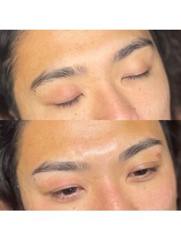 ニューフェイス(NEW FACE)/before/after