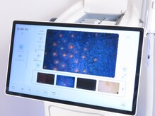 グローバルビューティー 池袋/IPL脱毛・光フェイシャル肌診断