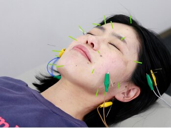 にしも鍼灸接骨院の写真/【お顔のもたつき解消&リフトUP★】新生活に向けて《美容鍼》♪たるみを改善し、食いしばりも楽になる◎