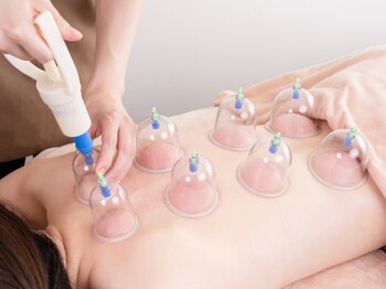 ボディケア ハナ(HANA)/9　カッピング