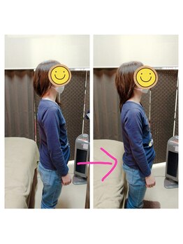 アリアーレ(ALIARE)/姿勢改善　１０