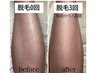 《男性》【痛みが少ない☆最短でツルツル】最新LED脱毛　全身（顔/VIO込み）