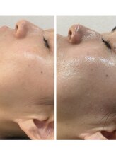 シエロ(Cielo)/内側から輝く透き通るツヤ肌☆