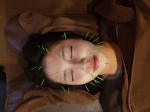 ココロ(CoCoLo)/美容鍼灸