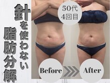 ルーナ(LUNA)/即効性バツグン♪