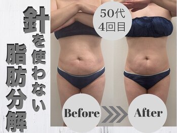 ルーナ(LUNA)/即効性バツグン♪