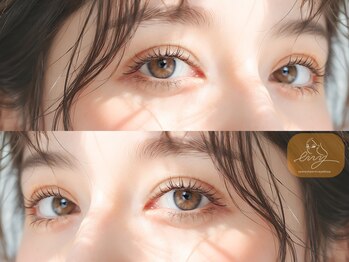 エニー 堺東店(eny)の写真/【大注目☆ダブルアイリフト】一重・奥二重・瞼のたるみにお悩みの方に♪アイストレッチでぱっちり二重に◎