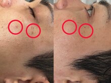 ヨハク(YOHAKU)/プラピール