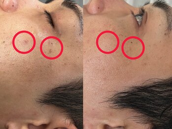 ヨハク(YOHAKU)/プラピール