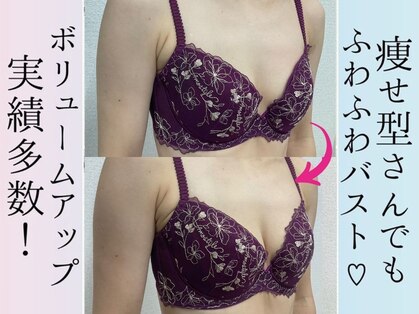 バーディー(BIRDIE)の写真