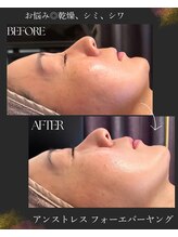 エヌア(nA)/【フォーエバーヤング】