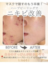 ノット(knote)/衝撃ビフォアフ1