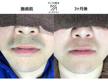サロンアメリ イオンモール綾川店(Salon Ameri)の雰囲気（店内は女性専用と男性専用で区切られております◎）